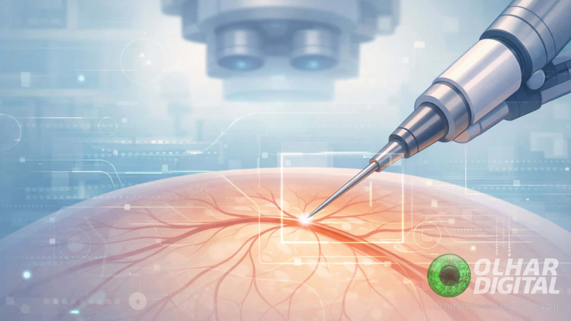 Cirurgia no limite do invisível: robô usa IA para operar veias da retina